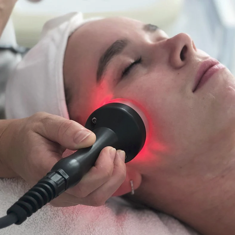 Radio Frequency Skin Tightening