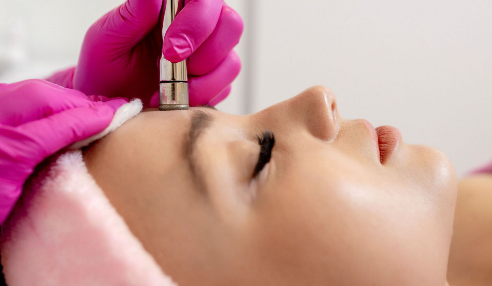 Microdermabrasion